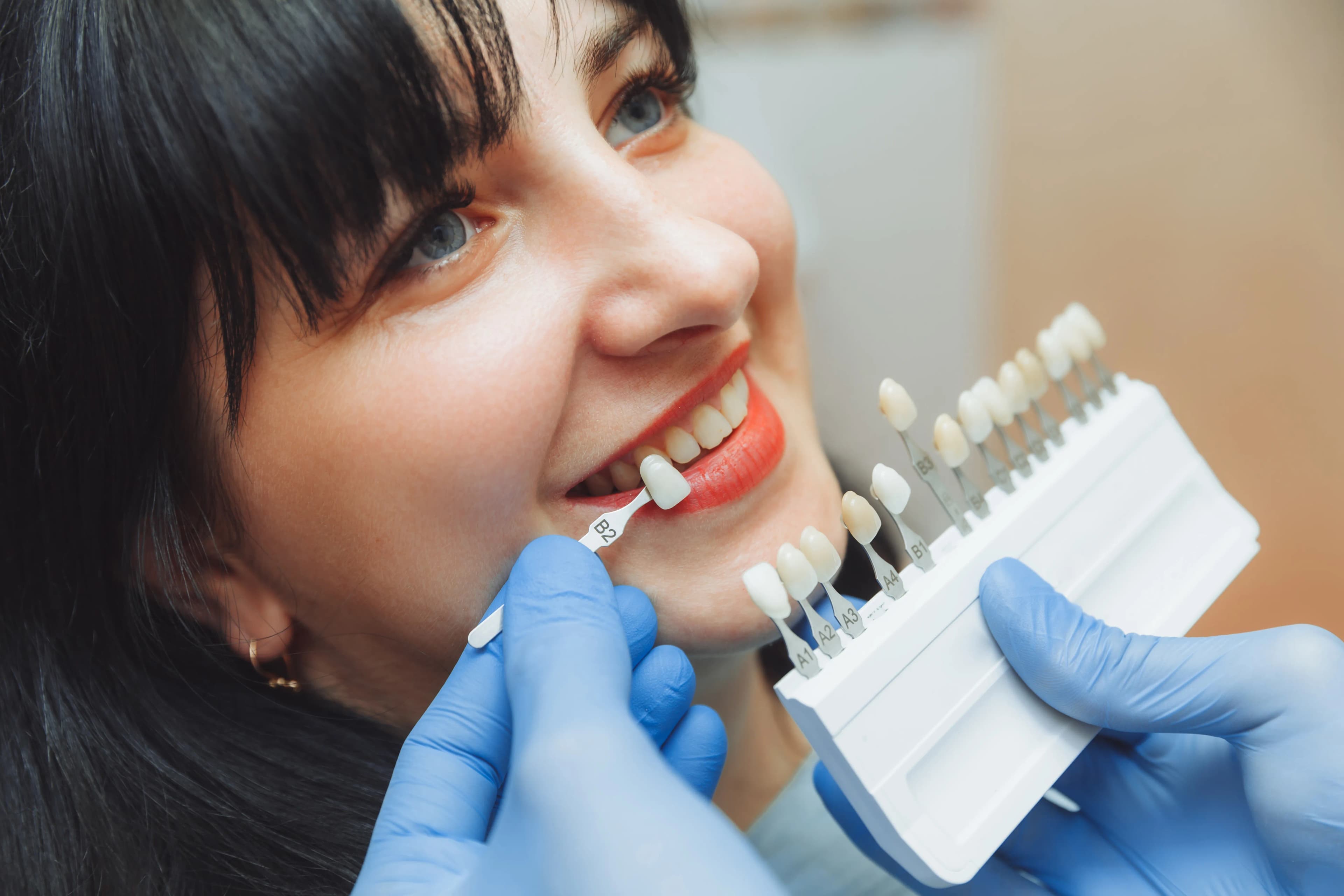 Ottawa Dental Centre Lumineers in Ottawa